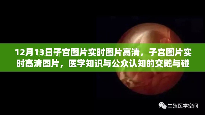 医学知识与公众认知交融，高清子宫图片实时展示与探讨