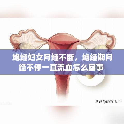 绝经妇女月经不断，绝经期月经不停一直流血怎么回事 