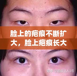 脸上的疤痕不断扩大，脸上疤痕长大能变淡吗 