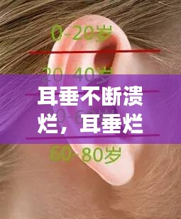 耳垂不断溃烂，耳垂烂了怎么回事 