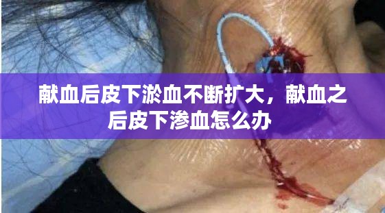 献血后皮下淤血不断扩大，献血之后皮下渗血怎么办 