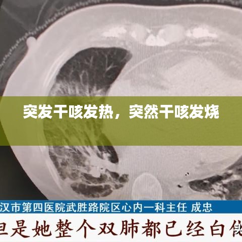 突发干咳发热，突然干咳发烧 