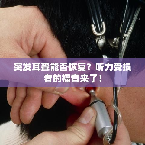 突发耳聋能否恢复？听力受损者的福音来了！