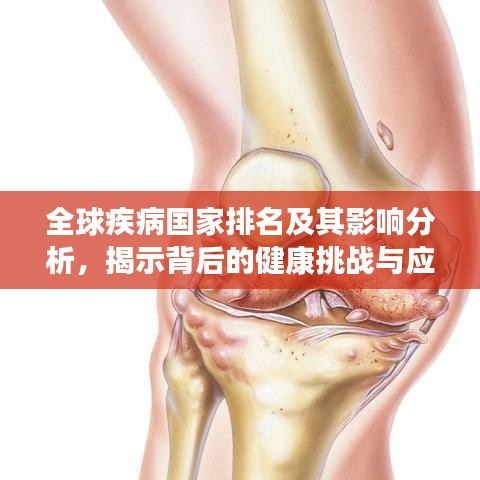 全球疾病国家排名及其影响分析，揭示背后的健康挑战与应对策略