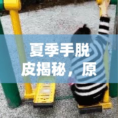 夏季手脱皮揭秘，原因、预防与治疗方法