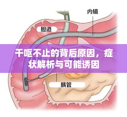 干呕不止的背后原因，症状解析与可能诱因